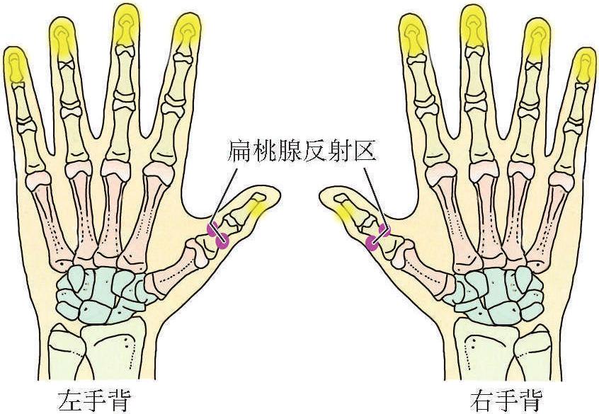 (三)小兒發(fā)熱